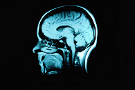 Atlanta Brain Injuries Attorney